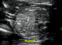 Real-Time B-Mode Ultrasound